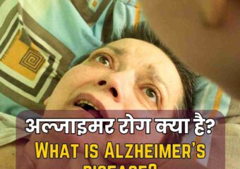 अल्ज़ाइमर रोग (Alzheimer’s Disease) क्या है? – मंथन हॉस्पिटल प्रयागराज
