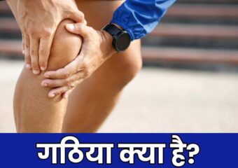 गठिया (Arthritis) क्या है?