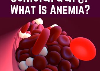 एनीमिया – अनदेखी थकान से संपूर्ण स्वास्थ्य तक – डॉ. अभिषेक द्विवेदी, मंथन हॉस्पिटल