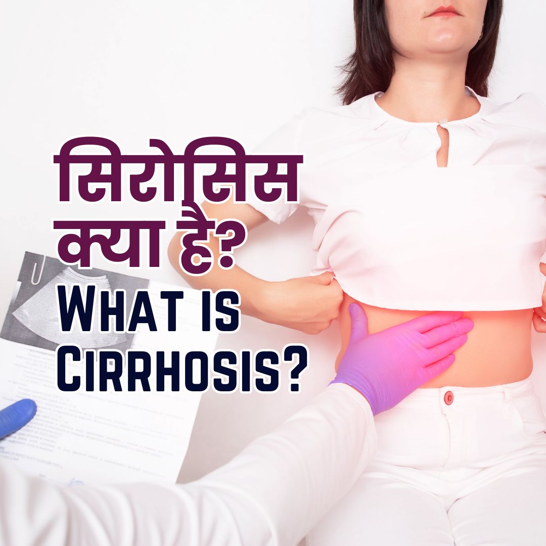 सिरोसिस (Cirrhosis) क्या है?