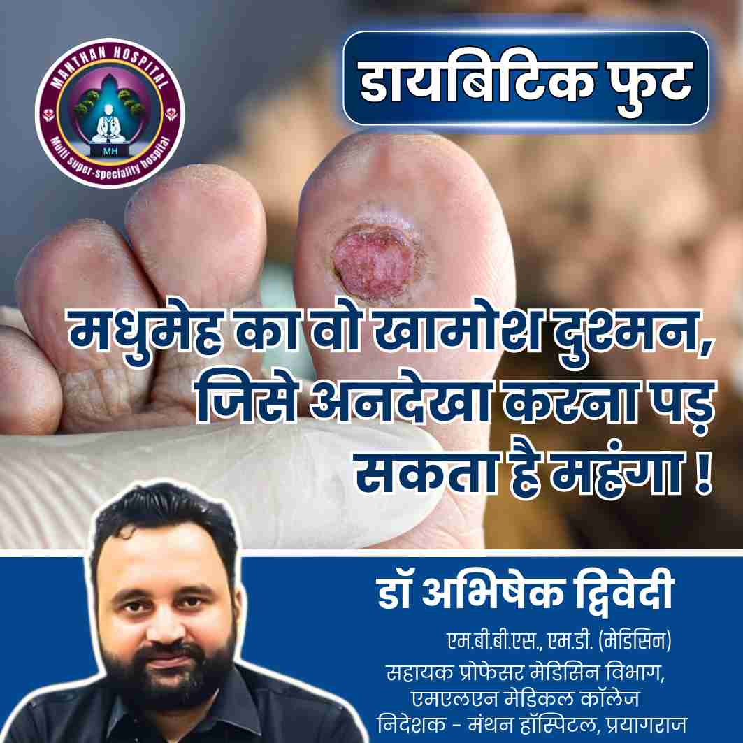 डायबिटिक फुट (Diabetic Foot) – मधुमेह का वो खामोश दुश्मन, जिसे अनदेखा करना पड़ सकता है महंगा ! – डॉ. अभिषेक द्विवेदी
