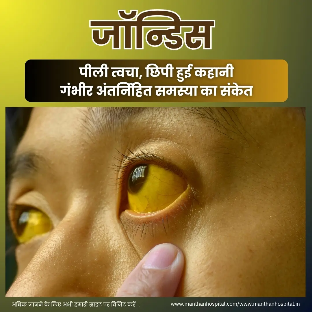 जॉन्डिस (पीलिया): पीली त्वचा, छिपी हुई कहानी – डॉ. अभिषेक द्विवेदी