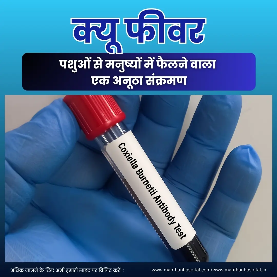 क्यू फीवर (Q Fever) : पशुओं से मनुष्यों में फैलने वाला एक अनूठा संक्रमण – डॉ. अभिषेक द्विवेदी