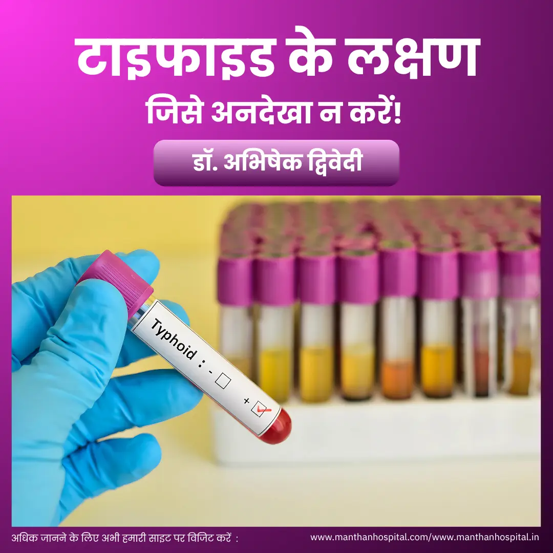 टाइफाइड के लक्षण: एक चेतावनी जिसे अनदेखा न करें! – डॉ. अभिषेक द्विवेदी
