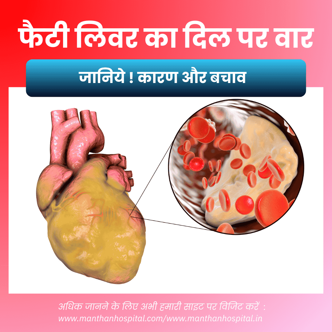 फैटी लिवर का दिल पर वार: डॉ. अभिषेक द्विवेदी की महत्वपूर्ण सलाह