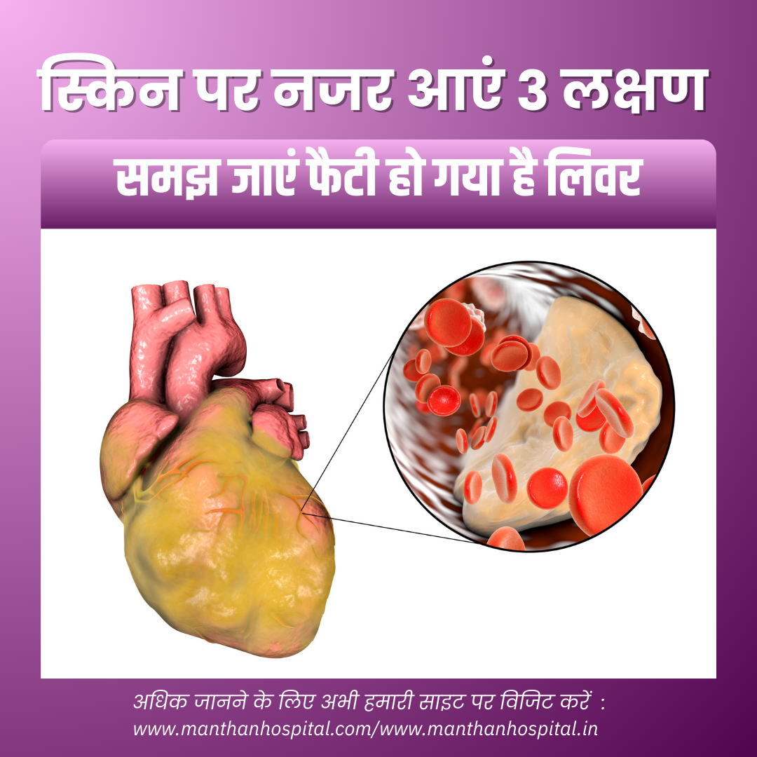स्किन पर नजर आएं 3 लक्षण तो समझ जाएं फैटी हो गया है लिवर: डॉ. अभिषेक द्विवेदी